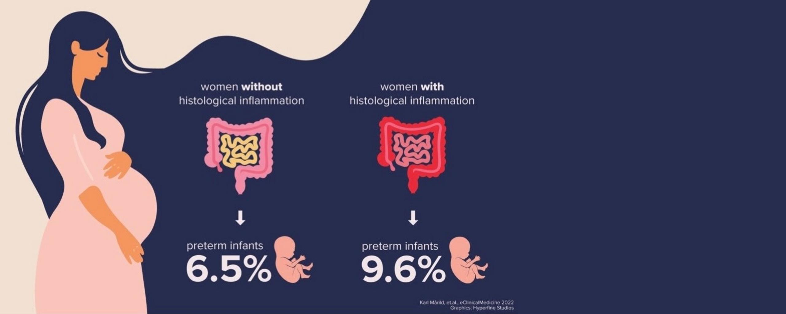 炎症性腸疾患