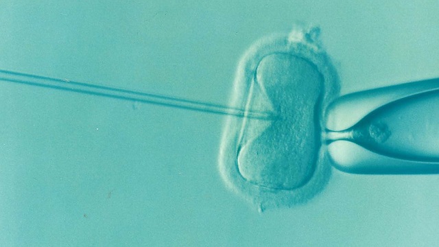 子宮腔内受精
